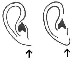 samples of an attached earlobe and detached earlobe drawing