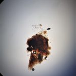 Microscopic image of Blotch Rot fungus, Physalospora vaccinii (Maine, November 2018)