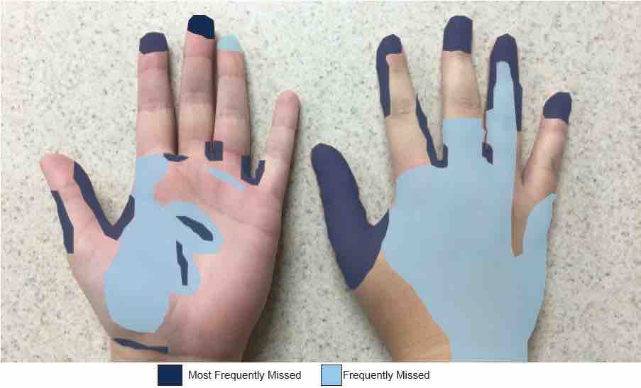 Image showing the most-missed areas on your hand when handwashing: palm, thumb, fingertips, and back of hand