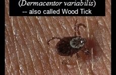 image of a non-engorged American Dog Tick