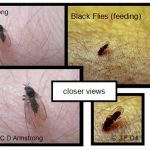A composite photo that shows two images of three black flies in total, all starting to feed on a person.