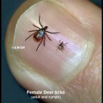 Photo of two female deer ticks (one adult and one nymph) on a person's thumbnail.