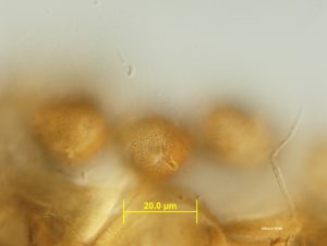 Aeciospores - surface