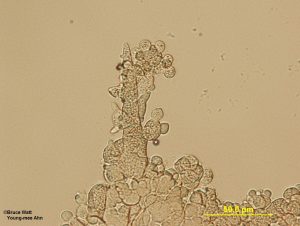 Sample 1: Conidium with globose cells