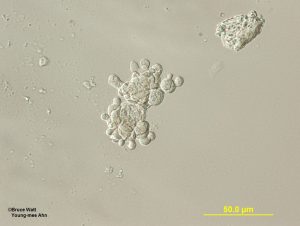 Sample 1: Globose cells
