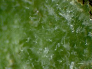 Sample 2: Conidia on leaf