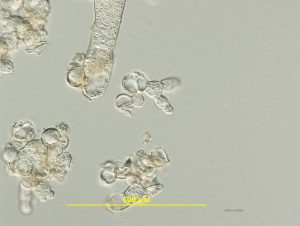 Sample 2: Globose cells