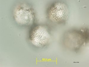 Sample 2: Aeciospores surface