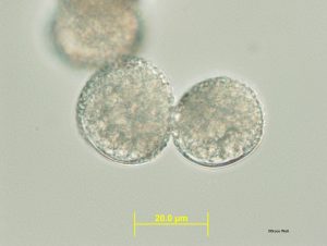 Sample 2: Aeciospores