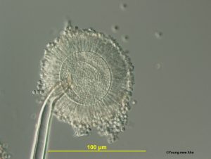 Aspergillus vesicle with sterigmata