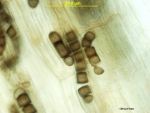 Chlamydospores in roots