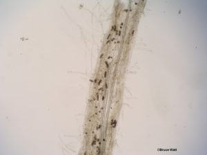 Chlamydospores in roots
