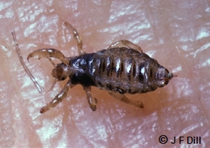 Head Lice - Cooperative Extension: Insect Pests, Ticks and Plant Diseases -  University of Maine Cooperative Extension