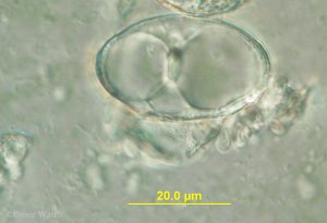 microscope view of powdery mildew conidium