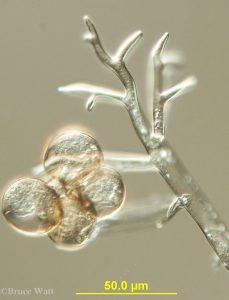 spores and sporangiophores under scope
