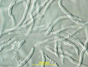 Septoria spores under microscope