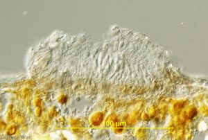 microscope view of Colletotrichum pathogen