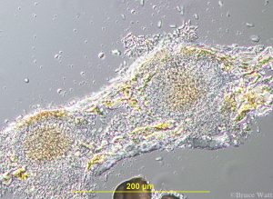 Microscope view of Phoma pathogen