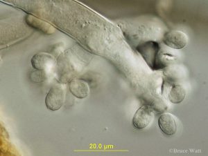 Conidia and conidiophores under microscope
