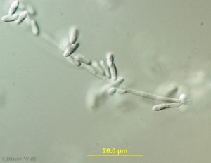 Conidia and conidiophore under microscope