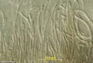 Microscope view of conidia