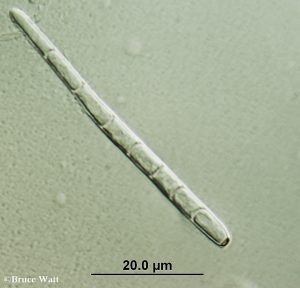 conidium under microscope