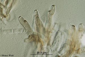 conidiophores under microscope