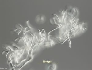 Sporangiophores under microscope
