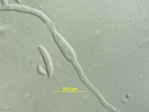 Phialides with microconidia