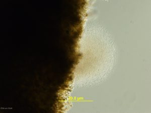 Bacteria streaming out of tissue