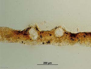 Croos-section of pycnidia