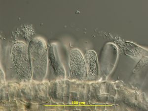 Asci with ascospores