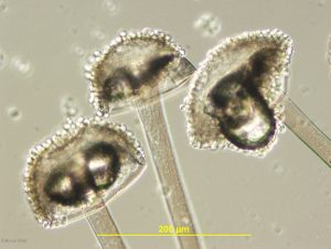 Sporangia with attached spores