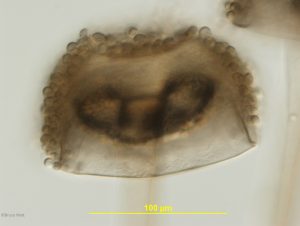 Sporangium with attached spores