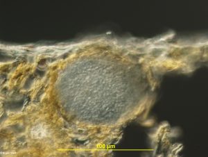 Cross-section of pycnidia in leaf