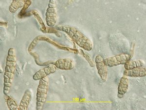 Conidiophores and conidia