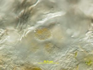 Cross-section of uredinium with urediniospores