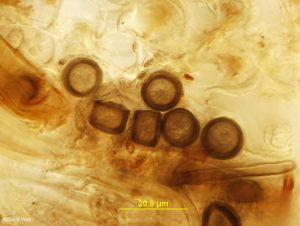 Chlamydospores in root tissue
