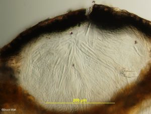 Vertical section of hysterothecium with mature asci surrounded by paraphyses