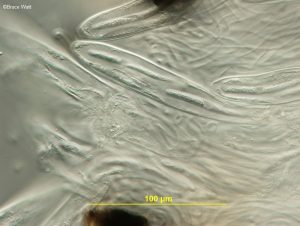Mature asci with spores and surrounding paraphyses