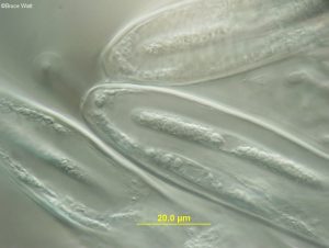 Mature asci with spores