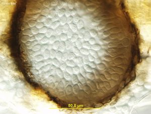 Cross-section of pycnidium in plant tissue