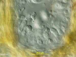 Cross-section of pycnidium