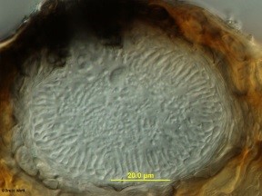 Enlarged Magnified Picture of Spermagonium