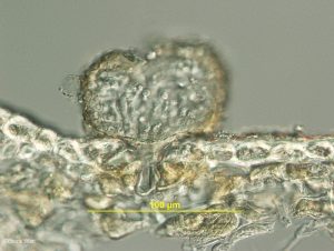 Vertical section of pycnidium emerging from stoma