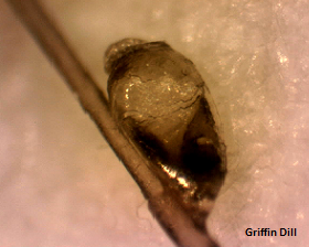 Hair Shaft with Nit attached (at 40x magnification)