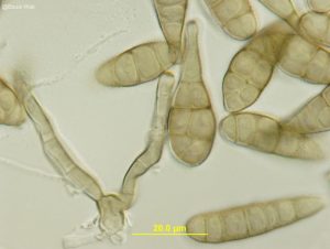 Conidia and conidiophores