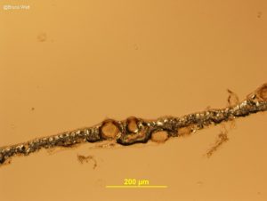 Pycnidia in leaf tissue- Vertical section