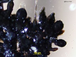 Close-up of pseudothecia and a pycnidium in the fungal mass