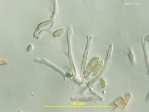 Conidiophores and conidia